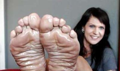 Puckered feet