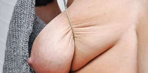 Saggy floppy hangers - part