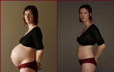 Before and After - Pregnant